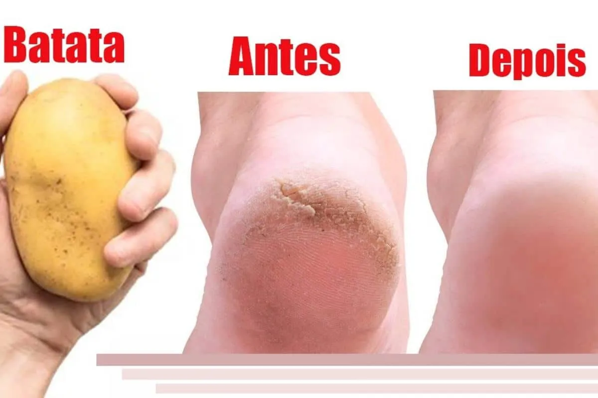 Como deixar os pés lisos e hidratados: técnica infalível que uma podóloga me ensinou