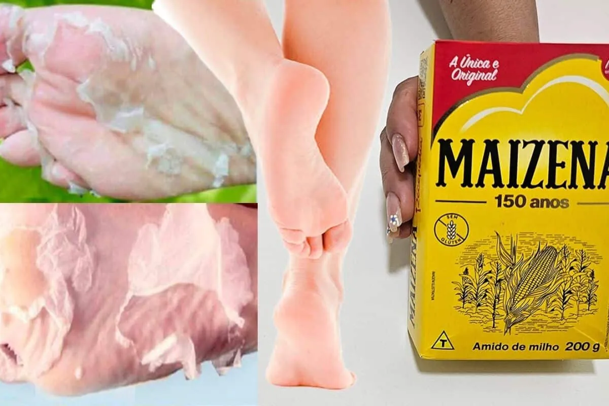 Como tirar rachadura dos pés: solução caseira que funciona para acabar com a pele seca e deixar os pés macios.
