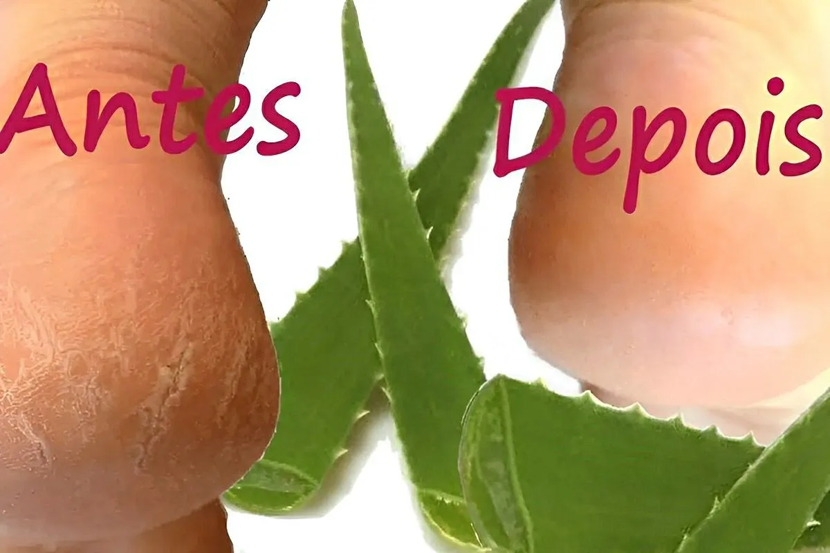 Como tirar rachaduras dos pés sem gastar muito usando apenas ingredientes naturais