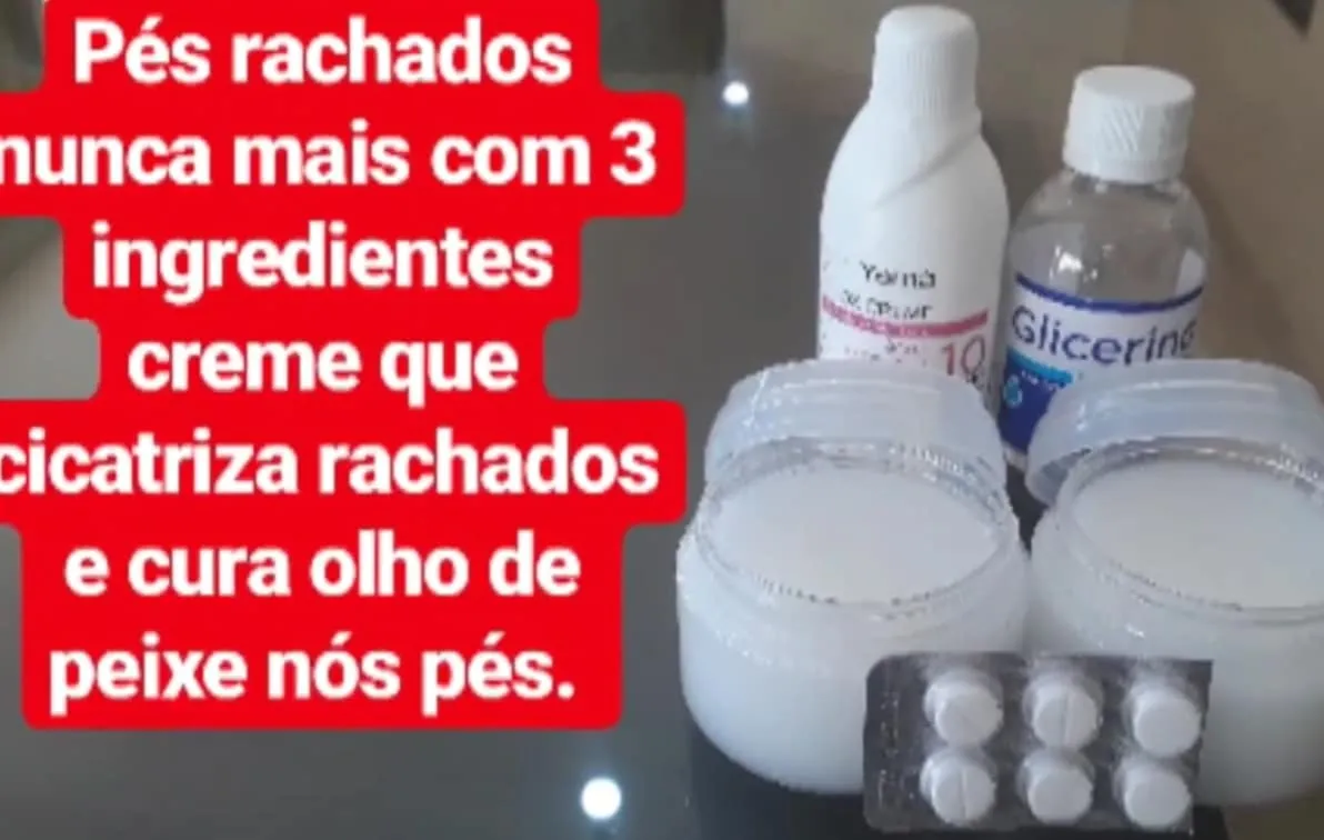 Creme para rachaduras dos pés: faça o creme com 3 ingredientes e resolva o problema dos seus pés