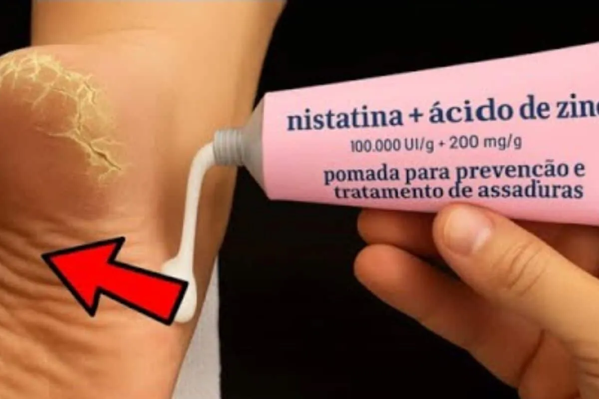 Dica ótima e fácil de fazer de como tirar rachaduras dos pés rapidinho