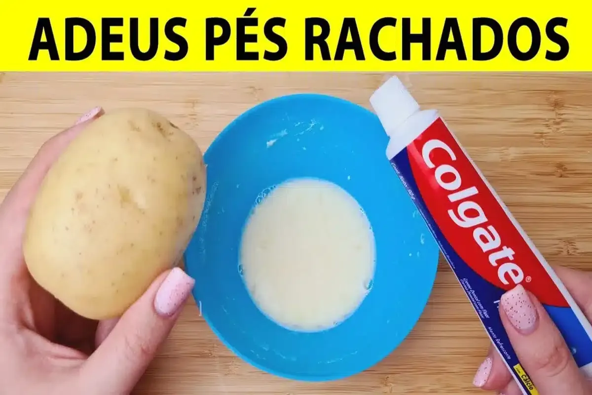 Essa é a melhor dica para pés rachados que você vai encontrar essa semana