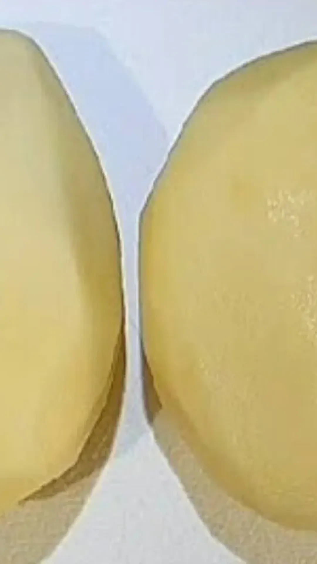 Bolinho de batata que fica delicioso com apenas 2 batatas: bem fácil de preparar